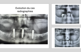 cas clinique