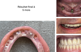cas clinique