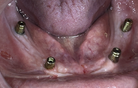 CAS CLINIQUE