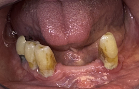 CAS CLINIQUE