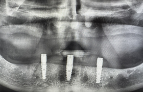 cas cliniques