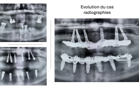 dentiste Walbourg